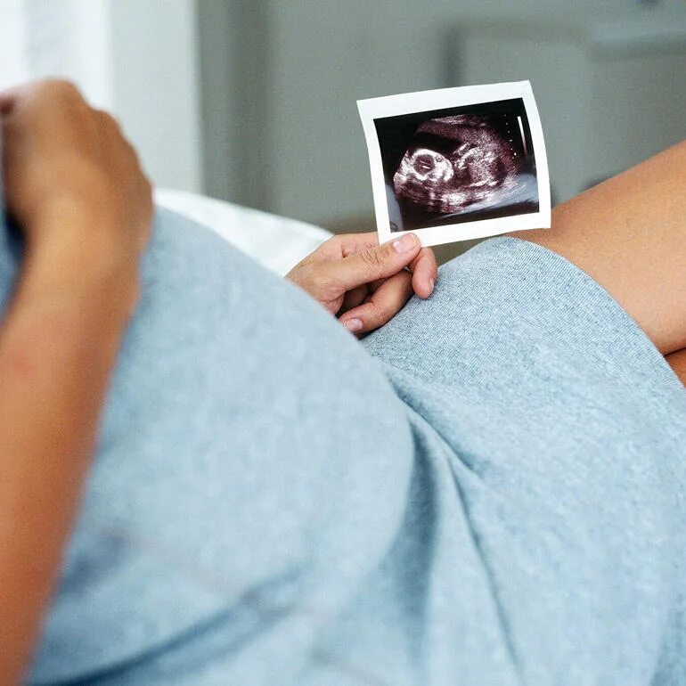 Узи первого триместра. Беременность. УЗИ по беременности. Скрининг беременной.