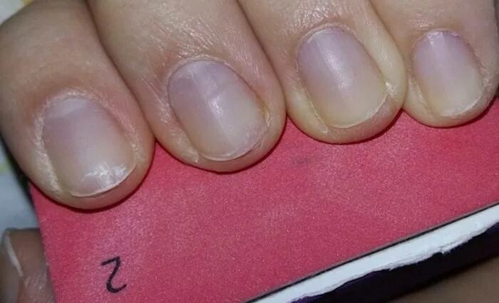 От чего синеют ногти