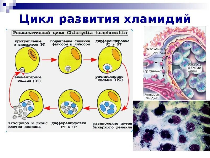 Хламидии клетки пораженные. Хламидии строение клетки. Строение хламидии микробиология рисунок. Хламидии строение микробиология.