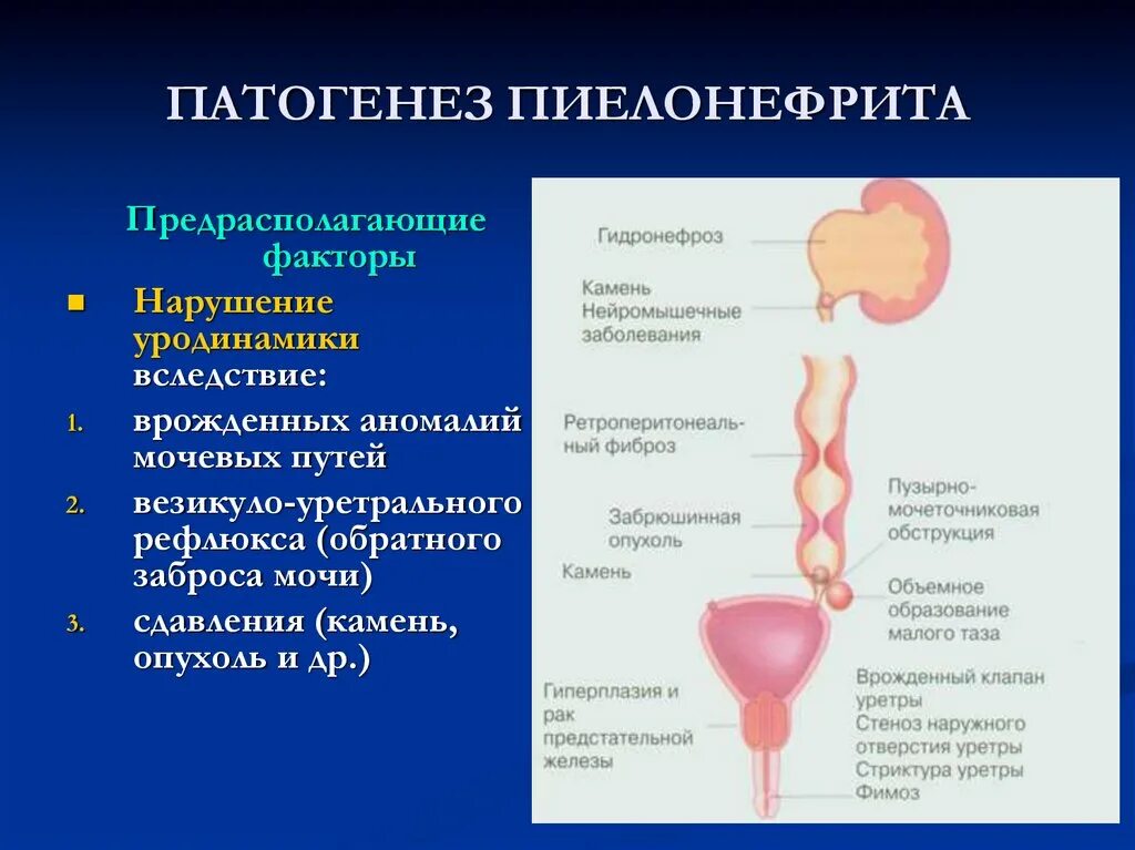 Какие симптомы мочевого пузыря