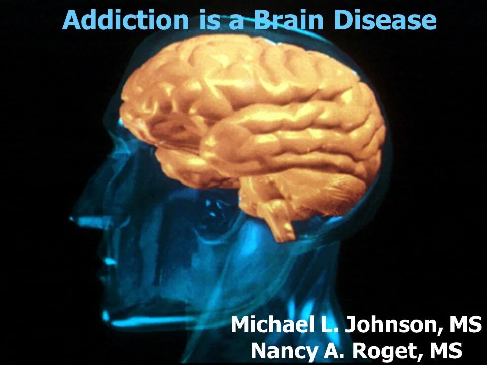 Мозг ms3. Мозг болезнь шапочка кардинала. Addicted Brain. Brain disease