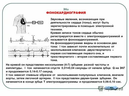 Тоны клапанов