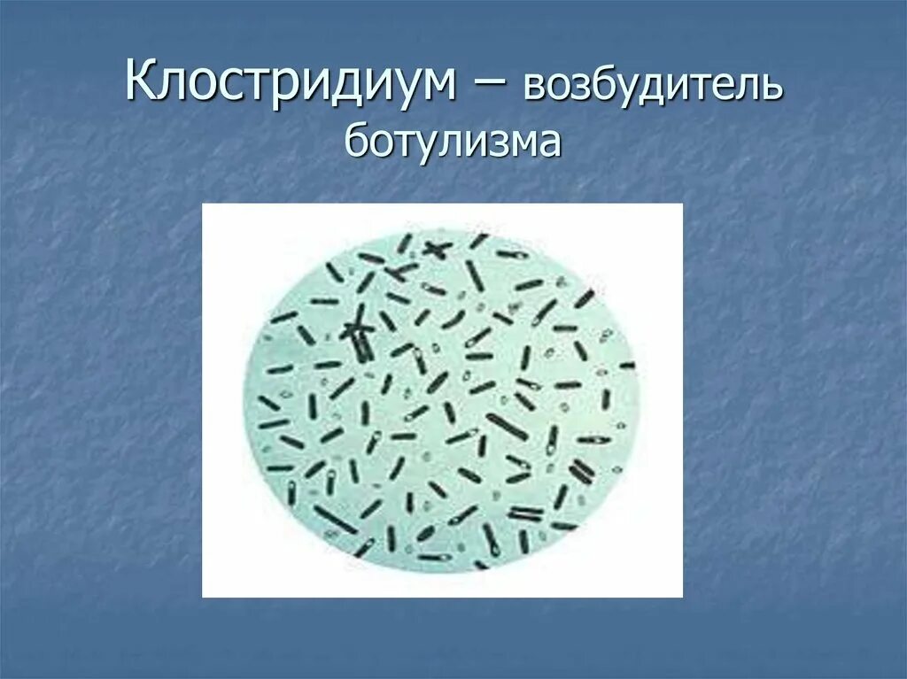 Клостридия ботулизма. Клостридии ботулизма ( Clostridium botulinum ) ботулизм. Возбудитель - Clostridium botulinum.