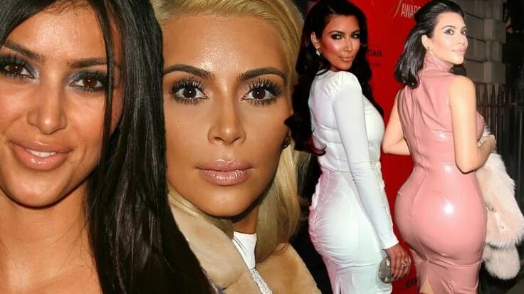 Кардашьян до и после операций Botox + OPs: Du siehst so anders aus! Kim kardashian before, Botox, Plastic surg
