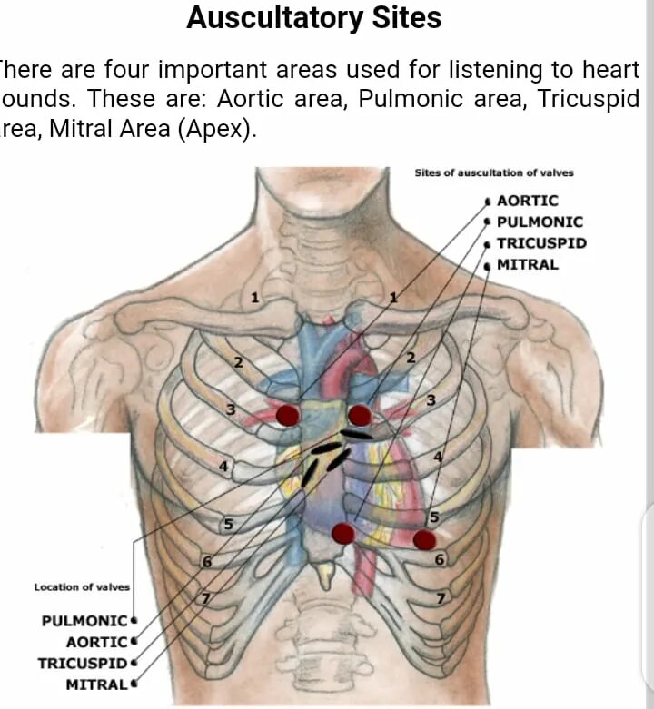 Проекция клапанов сердца на переднюю грудную. Схема проекции клапанов сердца. Проекции и точки аускультации клапанов сердца. 4 Межреберье аускультация сердца. Клапаны сердца на грудной клетке