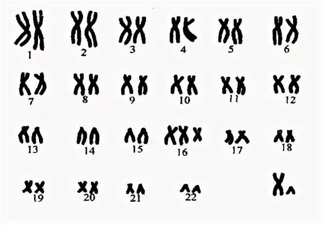 Хромосом группы d. Кариотип человека. Идиограмма кариотипа. Кариограмма хромосом человека. Кариограмма хромосом мужчины.
