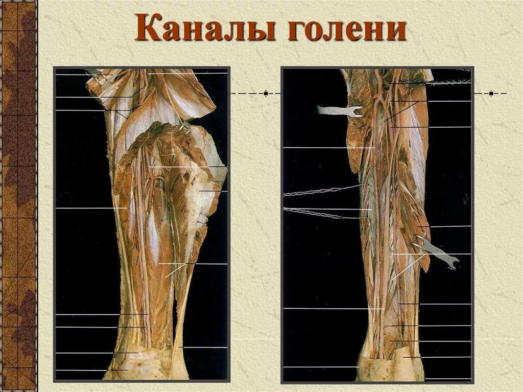 Топография подколенной ямки и голени. Canalis cruropopliteus анатомия. Каналы голени топографическая анатомия. Топография голени топографическая анатомия.