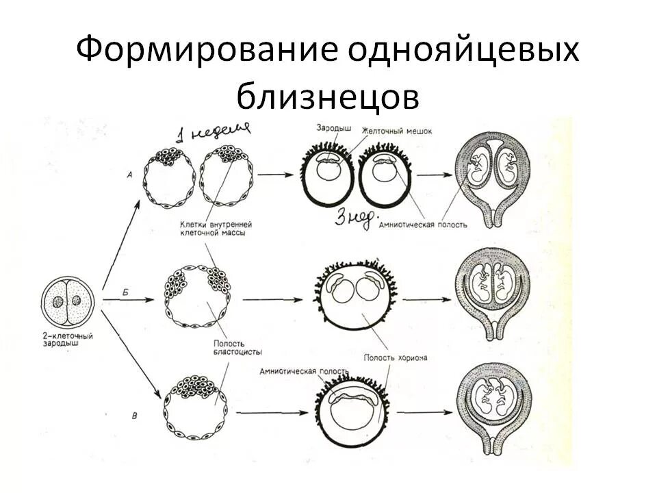 Чем оплодотворение отличается от. Многоплодная беременность разнояйцевые Близнецы. Схема образования однояйцевых и разнояйцевых близнецов. Возникновение однояйцевых близнецов. Механизм образования однояйцевых близнецов.