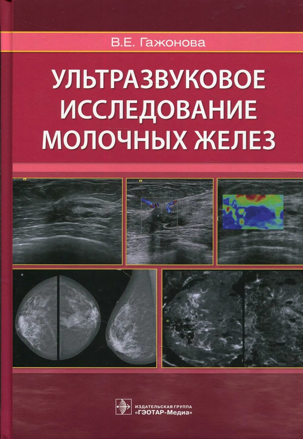 Ультразвуковая диагностика книги. Ультразвуковое исследование молочных желез Гажонова в.е. Гажонова УЗИ молочных желез. УЗИ молочных желез книга. Книги по УЗИ.