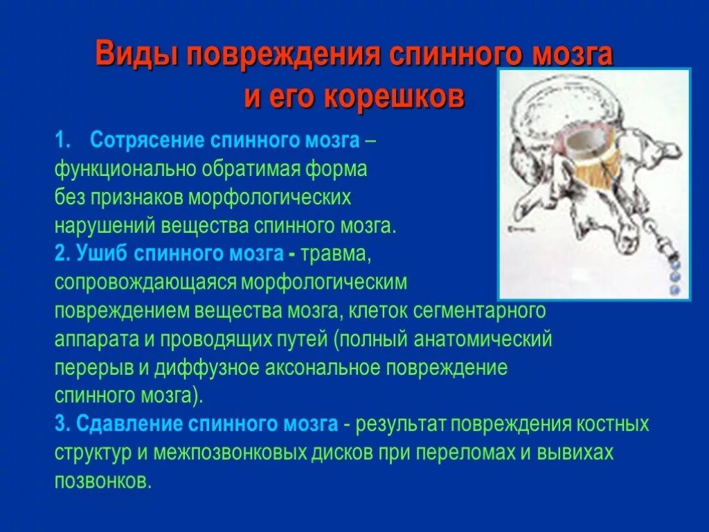 Сотрясение и ушиб спинного мозга. Сотресениеспинного мозга. Повреждение спинного мозга симптомы. Виды повреждений спинного мозга.