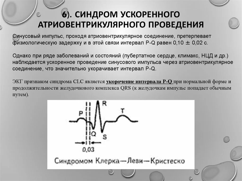 Что значит разогнать