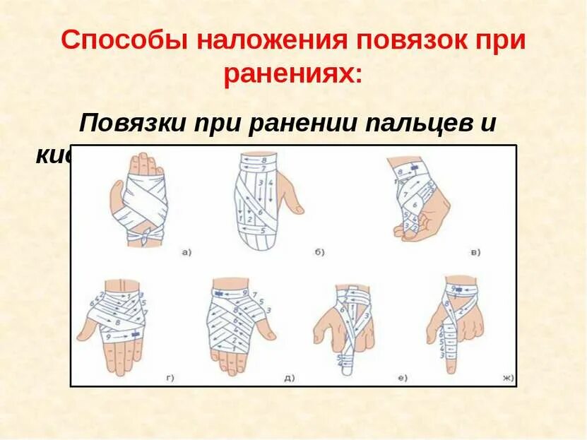 Бранолинд повязка мазевая ранозаживляющая с перуанским. Повязки при ранах и ожогах. Стерильная повязка при ожоге. Бранолинд н повязка мазевая стерильная. Наложение на рану сухой асептической повязки.