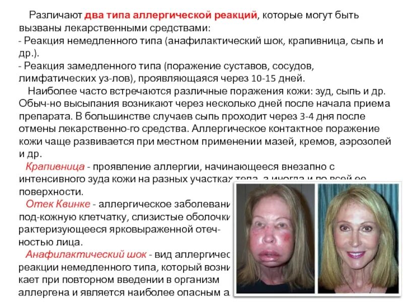 Аллергическая реакция по типу крапивницы шпаргалка для скорой помощи - фото през