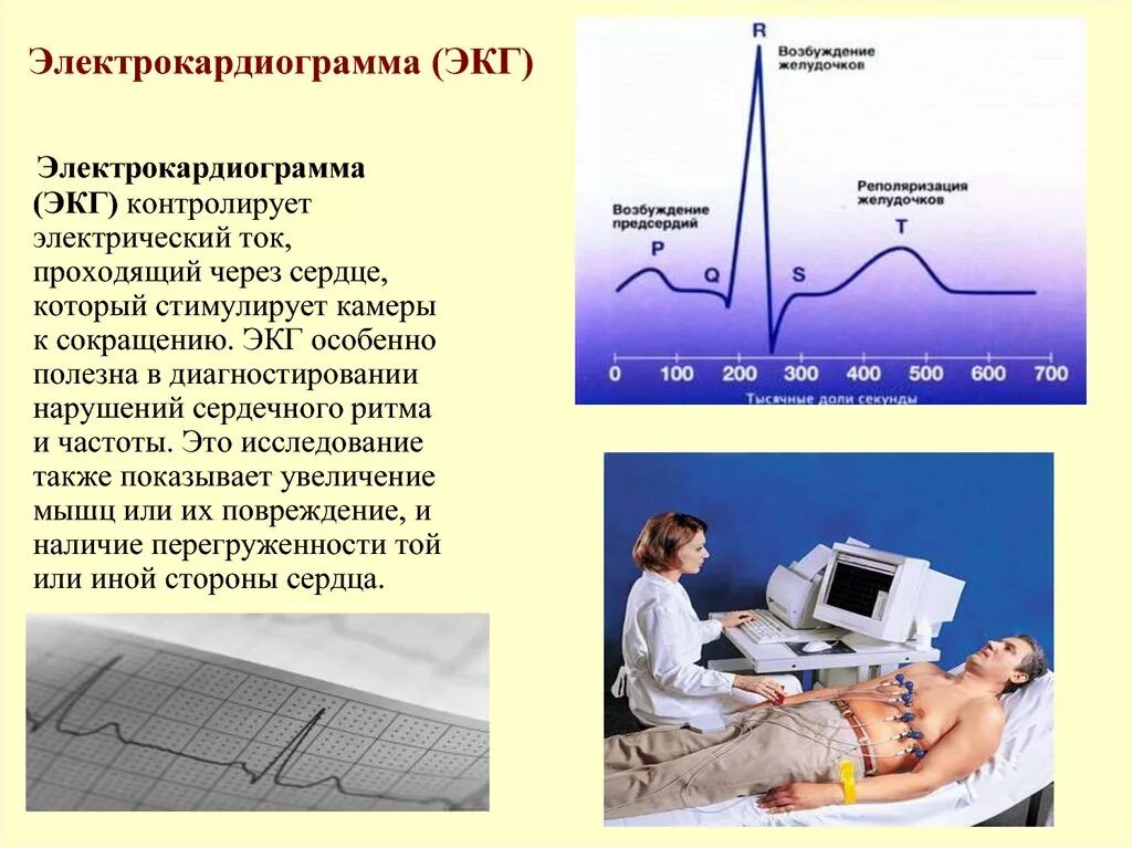 ЭКГ. Электрокардиография. Электрокардиография (ЭКГ). ЭКГ для презентации. В каких условиях необходимо проводить исследование экг