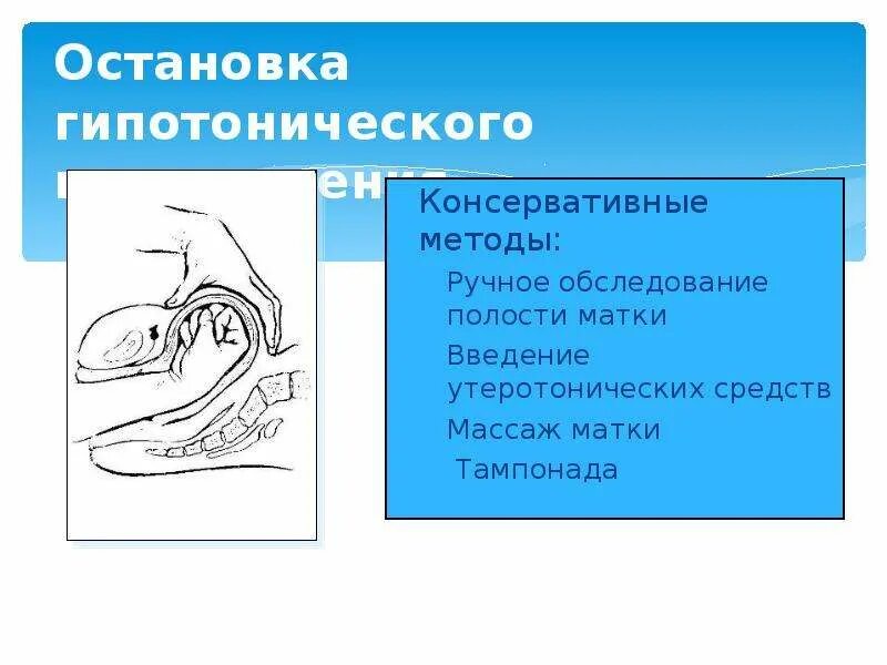 Массаж матки после родов. Наружный массаж матки в послеродовом периоде. Наружно внутренний массаж матки.