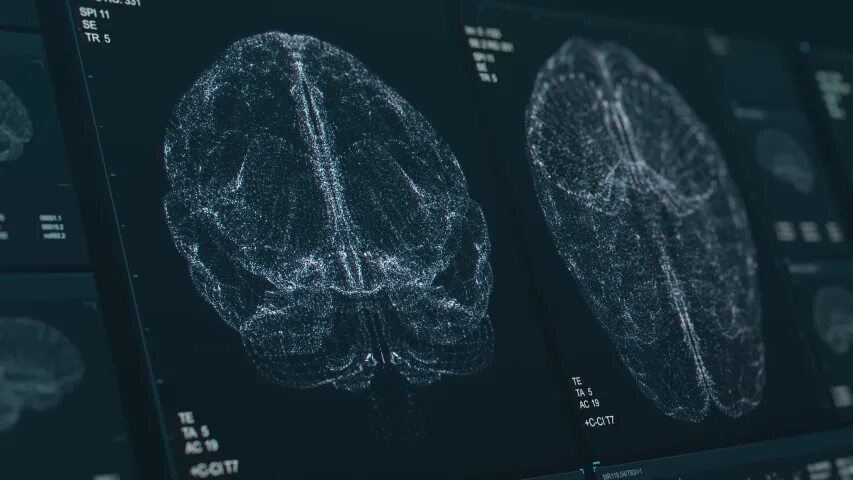 The brains video