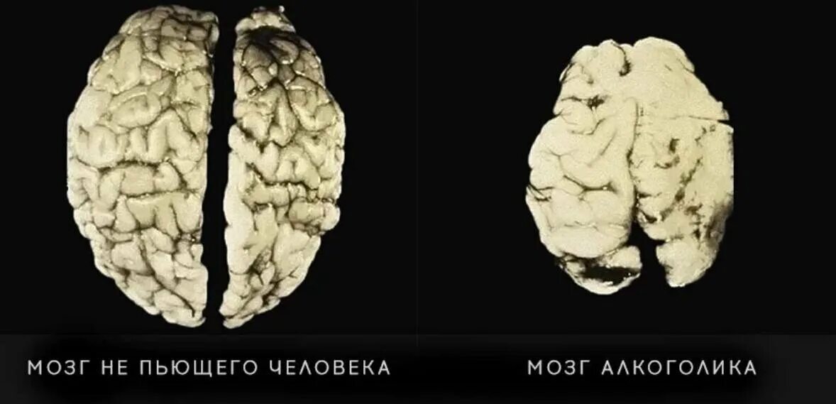 Нормальную человеческую
