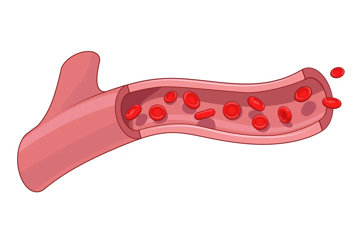 Сосуды без фона. Кровеносные сосуды вектор. Капилляры рисунок. Кровеносный сосуд мультяшный. Девочки мальчики сосуда