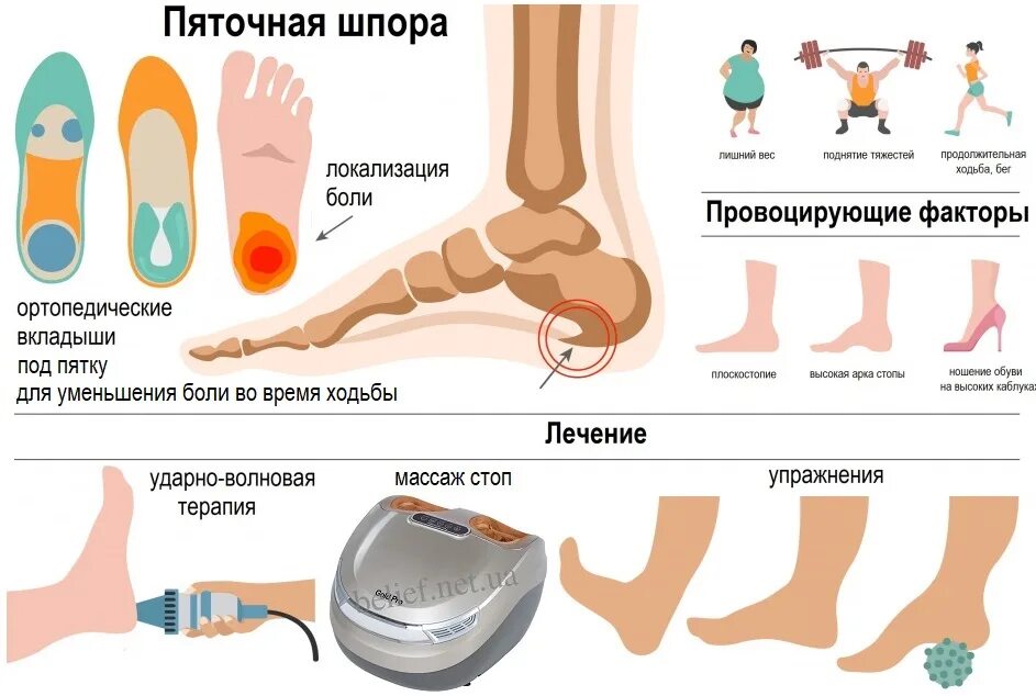 Почему появляется шпора