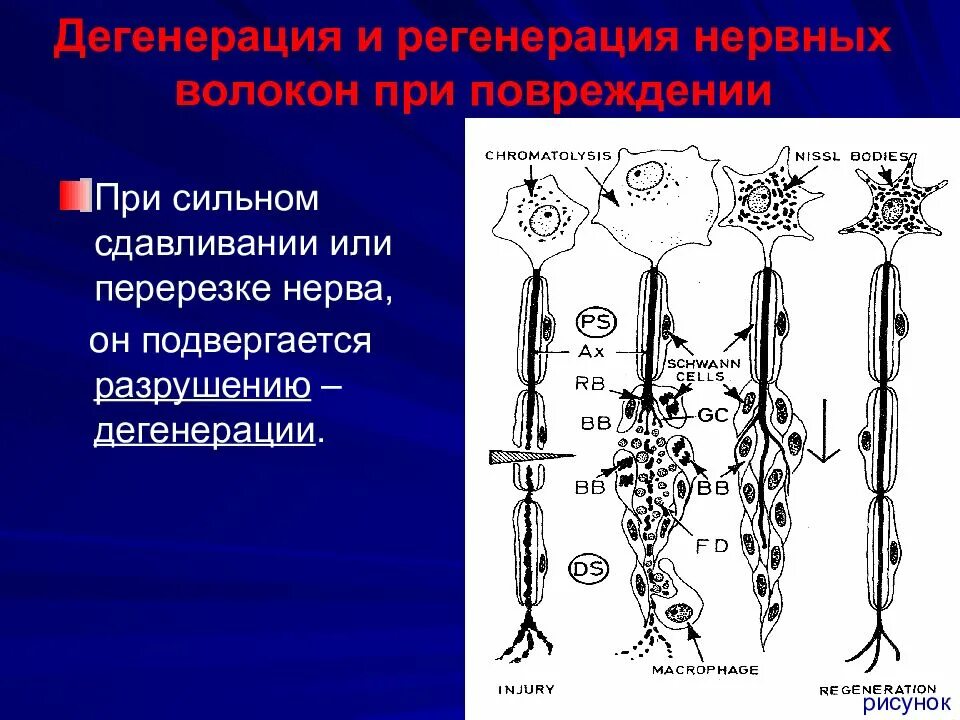 Дегенерация периферического нервного волокна.. Дегенерация и регенерация нервных волокон. Регенерация периферического нерва. Перерезка нервного волокна.