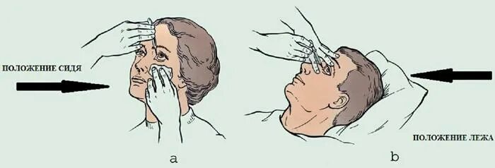 Капли в нос в глаза алгоритм. Закапывание капель в глаза. Закапывание в конъюнктивальный мешок. Закапывание глазных капель в конъюнктивальный мешок алгоритм. Алгоритм закапывания капли в глаза.