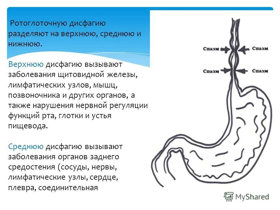 Лимфоузлы пищевода