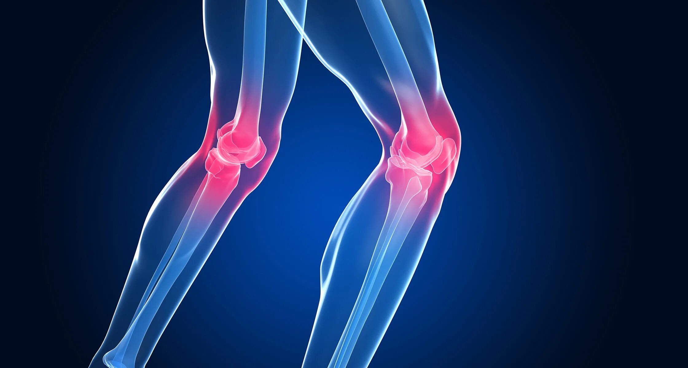 Больные коленные суставы. Инфекционный артрит коленного сустава. Суставқ ноги.
