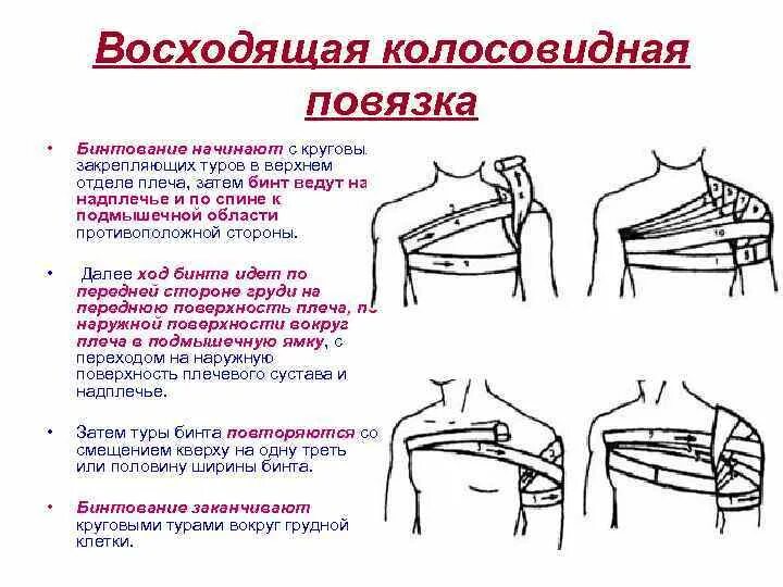 Колосовидная повязка алгоритм. Наложение колосовидной повязки на плечевой сустав алгоритм. колосовидная повязка на плечо показания. колосовидная повязка на плечевой сустав восходящая алгоритм. алгоритм наложения колосовидной повязки на плечевой.