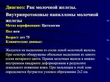 Диагноз с 50.9