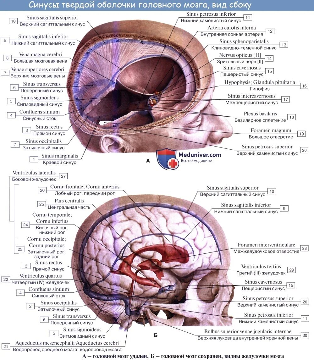 Синус оболочки мозга. Синусы твёрдой мозговой оболочки гемодинамика. Кавернозный синус твердой мозговой оболочки. Синусы твердой мозговой оболочки Неттер. Синусы твердой мозговой оболочки вид сбоку.