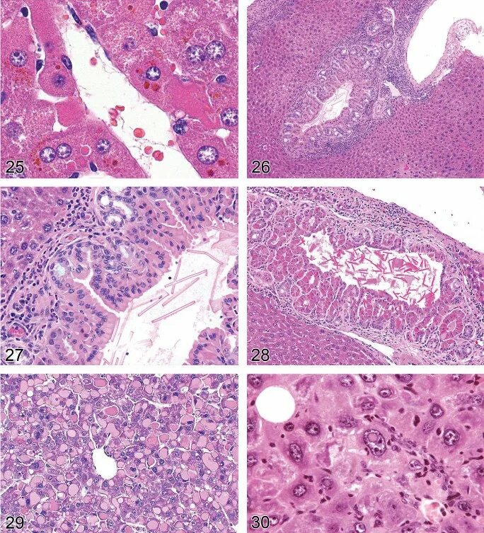 Клетки печени крыс. Печень крысы гистология. Печень крысы гистология препарат. Печень крысы при холестазе гистология.