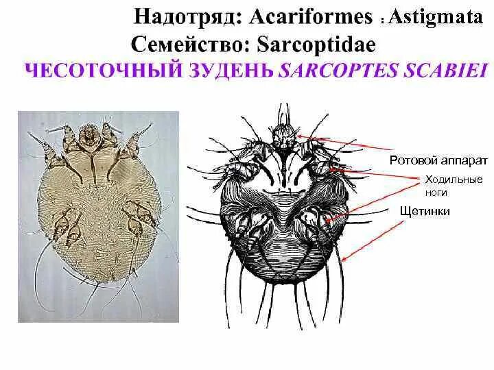 Чесоточный клещ Sarcoptes scabiei. Чесоточный зудень Sarcoptes scabiei строение. Жизненный цикл чесоточного клеща схема. Чесоточный зудень (Sarcoptes scabiei) укусы.