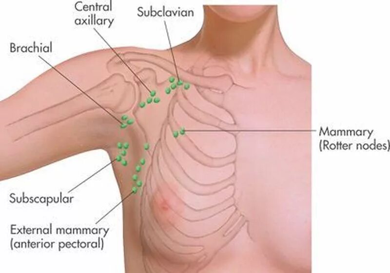 Расположенные под мышками. Воспаленный подмышечный лимфоузел. Подмышечные лимфатические узлы расположение. Подмышечные лимфоузлы пальпация. Лимфоузлы в подмышечной впадине расположение.