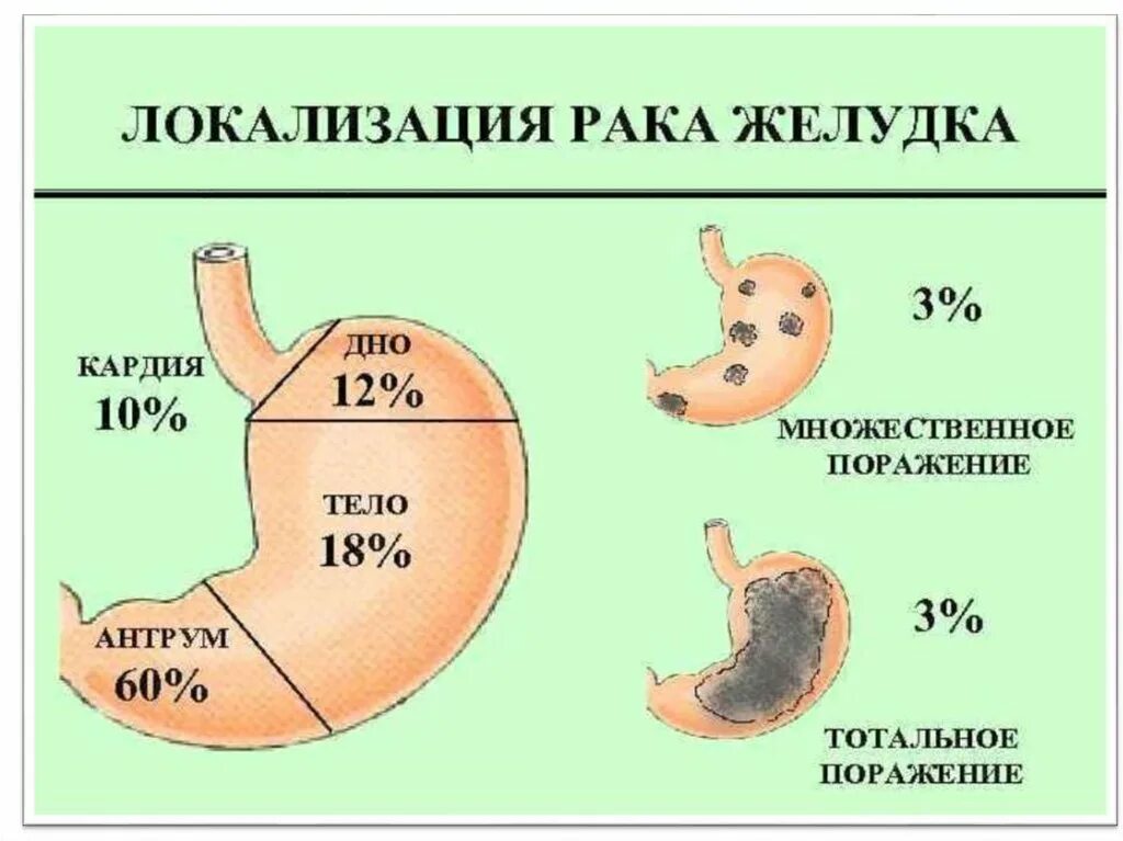 Признаки t r