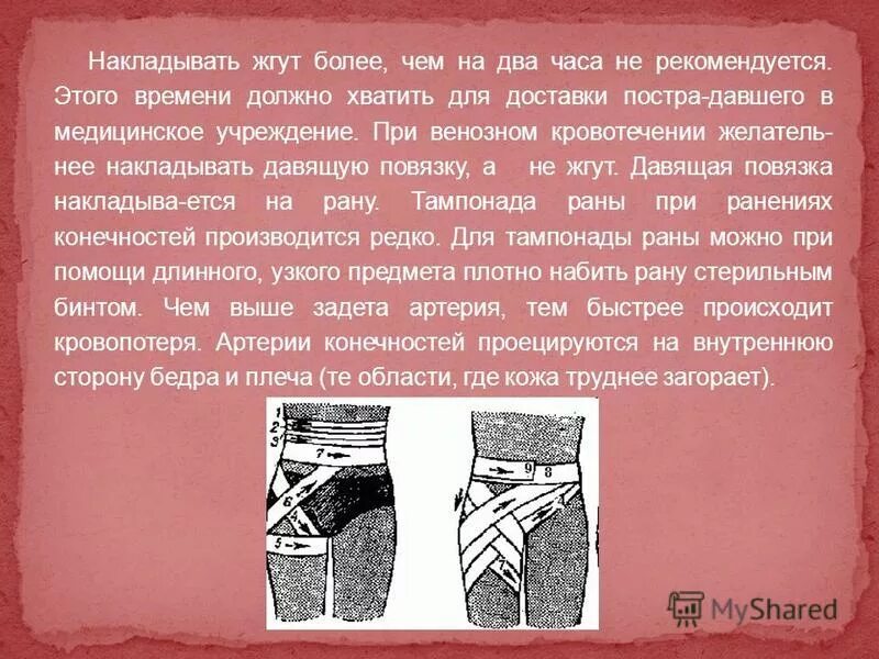 Оказание первой помощи при огнестрельном ранении. Жгут при огнестрельных ранениях. наложение повязки на огнестрельную рану. давящая повязка при огнестрельном ранении. первая помощь при огнестрельном.