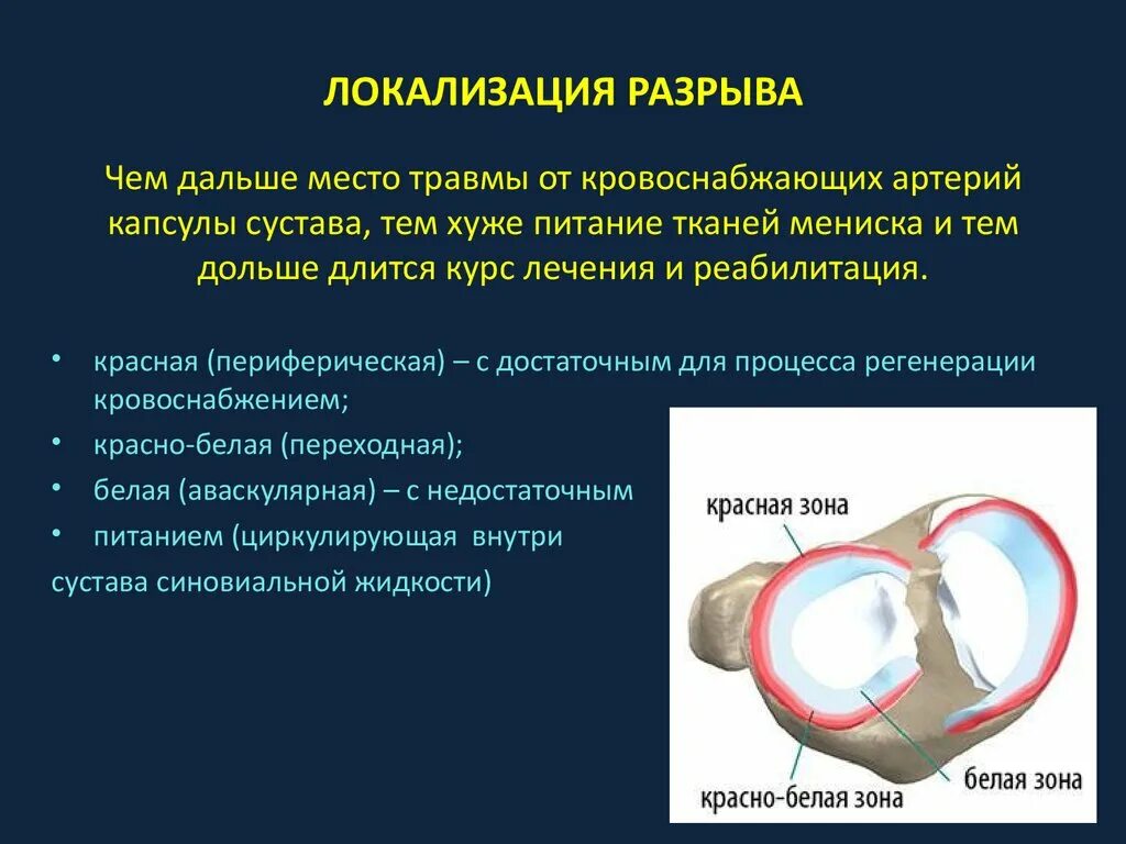 Рог мениска повреждение мениска коленного сустава. Разрыв мениска коленного сустава рентген. Разрыв рога мениска коленного сустава. Коленный сустав строение мениск. Признаки дегенеративных изменений менисков