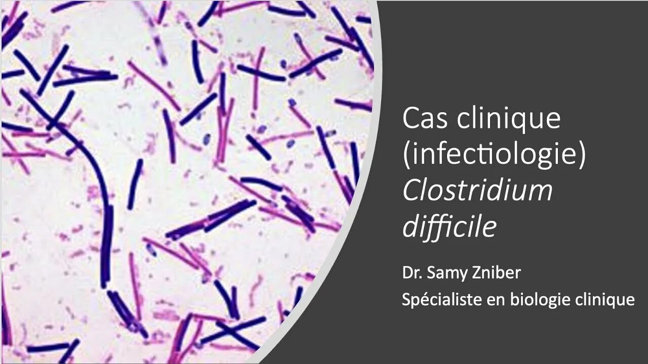Clostridium difficile что это. Clostridium difficile-ассоциированной болезни. Clostridium difficile культивирование. Чувствительность Clostridium difficile.