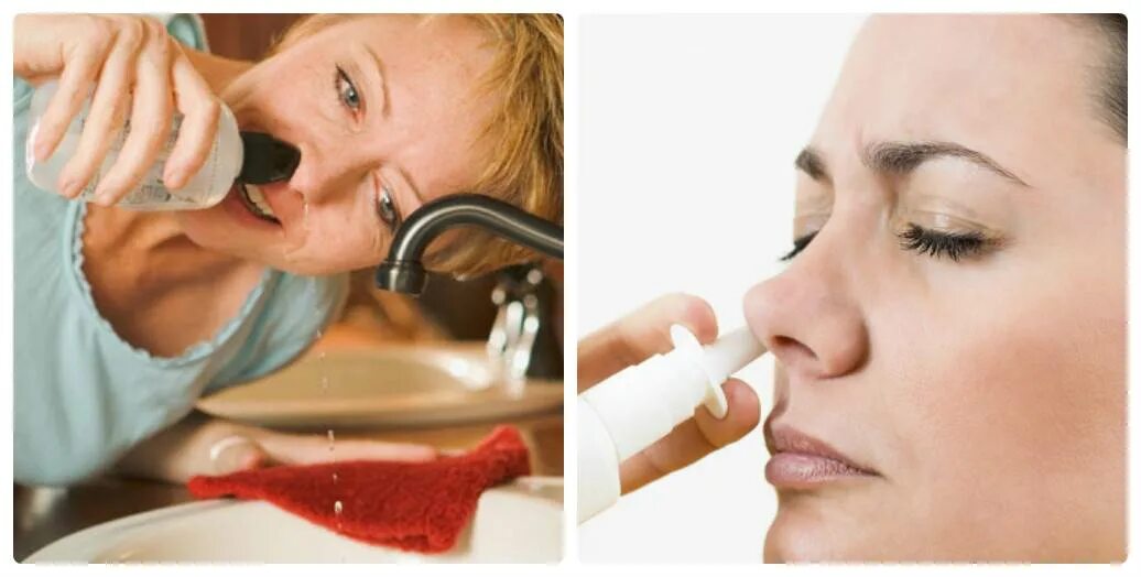 Заложенность носа и запах. При заложенности носа. Домашний метод от заложенности носа.