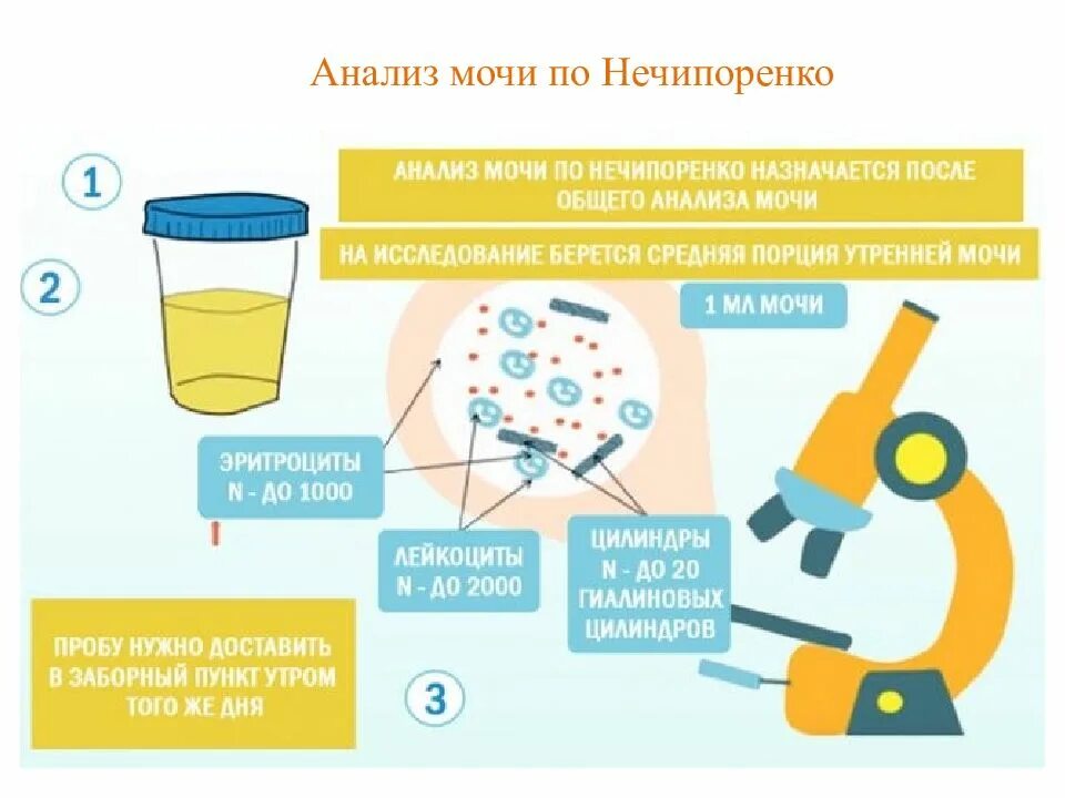 Сбор по нечипоренко. Алгоритм исследования мочи методом нечипоренко:. проба по нечипоренко алгоритм исследования. для исследования по нечипоренко мочу собирают. для исследования мочи по нечипоренко достаточно собрать мочи.