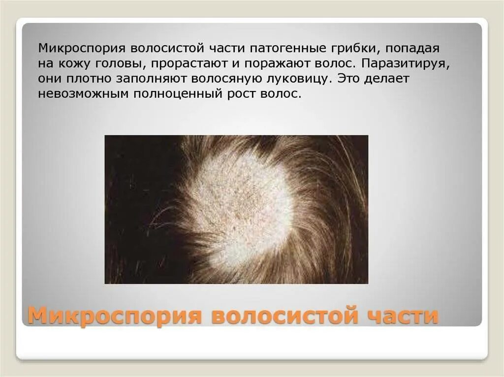 Внимание! Микроспория! - Государственное учреждение "Свислочский районный центр 