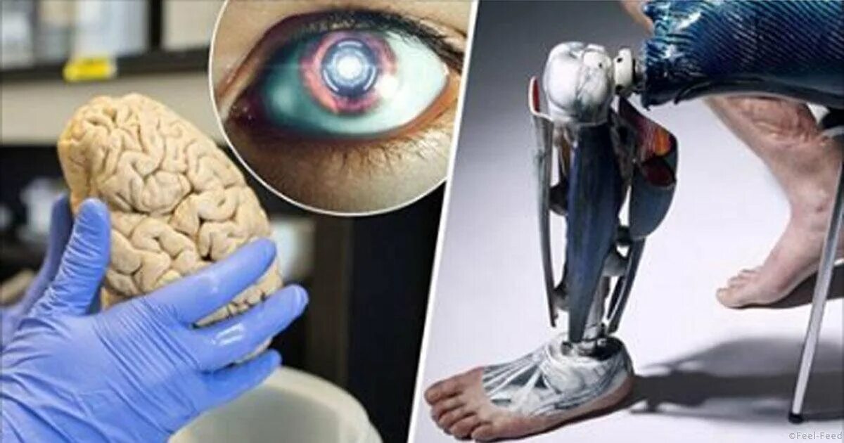 Протезы и искусственные органы. Бионические протезы. Искусственные органы человека. Полимерные искусственные органы.