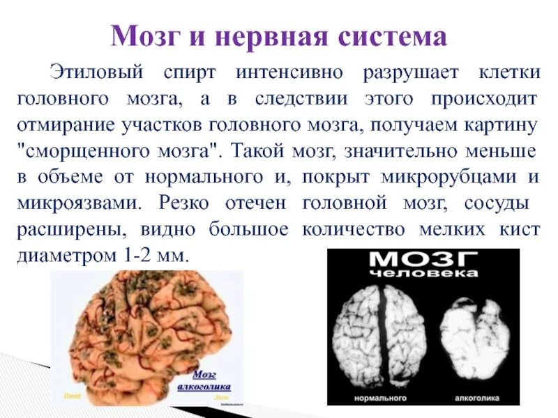 Болезни мозга названия. Отмирание клеток головного мозга. Отмирают клетки головного мозга. Разрушение клеток головного мозга.