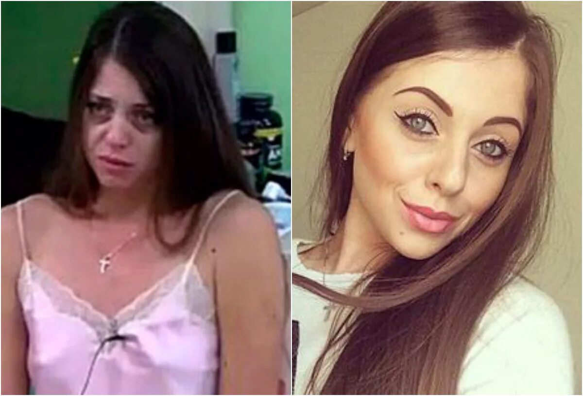 алена рапунцель до и после. алена рапунцель дом 2 до пластики. рапунцель до и после фото. алена рапунцель до пластики. алёна рапунцель до и после.