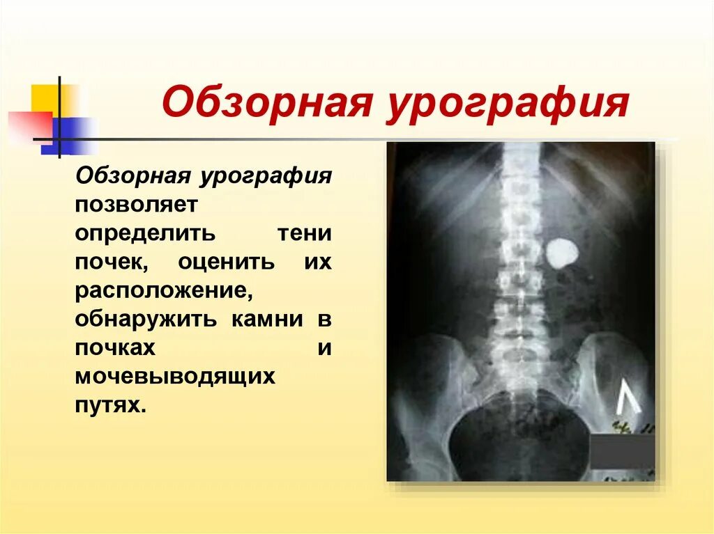 Сделать урографию