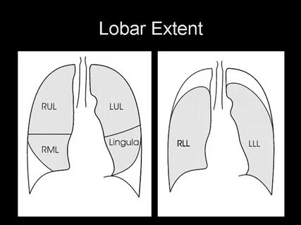 Extent