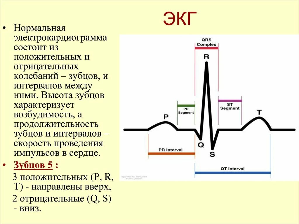 Отрицательный зубец р после QRS комплекса. ЭКГ PQRST расшифровка. Зубец r на ЭКГ В норме. Норма зубца QRS. Экг со скольки