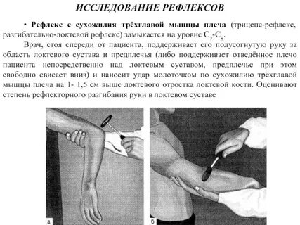 Мышечные рефлексы