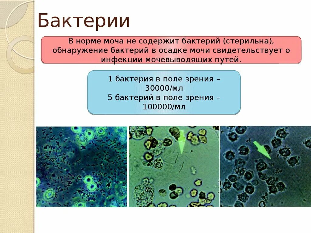 Ковид бактерия. Бактерии в моче. Бактерии в моче у женщин. Микроорганизмы в моче. Патогенные микроорганизмы в моче.