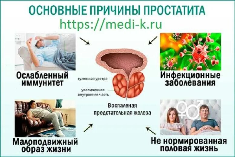 Простатит причины симптомы лечение. Аденома предстательной железы причины. признаки заболевания простаты у мужчин симптомы. хронический простатит. воспалительные заболевания предстательной железы.