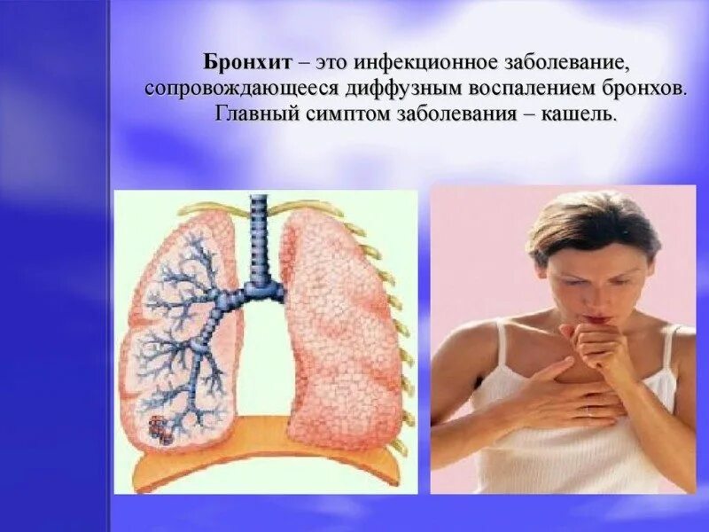 Месяц болею бронхитом. Заболевания органов дыхания бронхит. Хронический бронхит картинки. Легкие при остром бронхите.